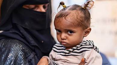 الصليب الأحمر: أكثر من 70 % من اليمنيين بحاجة إلى مساعدات إنسانية